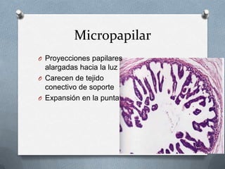 MicropapilarProyecciones papilares alargadas hacia la luzCarecen de tejido conectivo de soporteExpansión en la punta