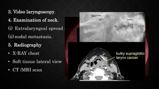 3. Video laryngoscopy.
4. Examination of neck.
(i) Extralaryngeal spread of disease
(ii) nodal metastasis.
5. Radiography
• X-RAY chest
• Soft tissue lateral view
• CT /MRI scan
 