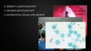 6. DIRECT LARYNGOSCOPY
7. MICROLARYNGOSCOPY
8. SUPRAVITAL STAIN AND BIOPSY
 