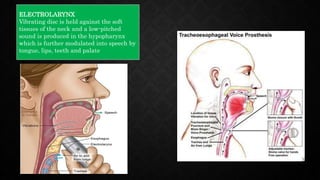 ELECTROLARYNX
Vibrating disc is held against the soft
tissues of the neck and a low-pitched
sound is produced in the hypopharynx
which is further modulated into speech by
tongue, lips, teeth and palate
 