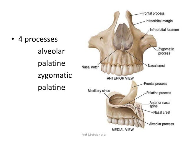 Carcinoma Maxillary sinus | PPTX