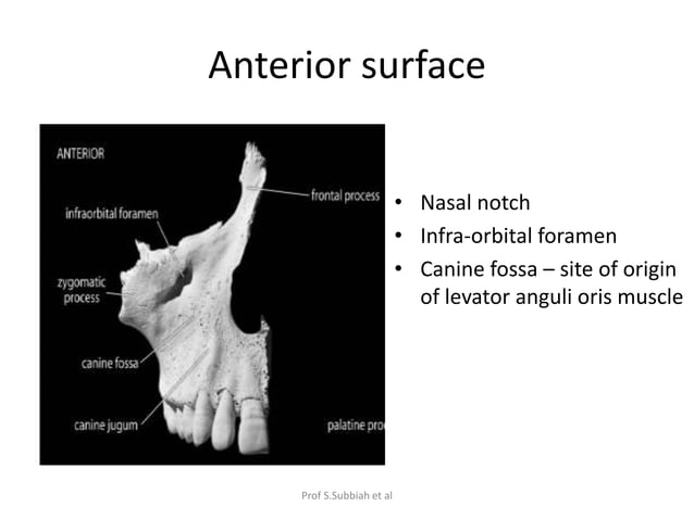 Carcinoma Maxillary sinus | PPTX