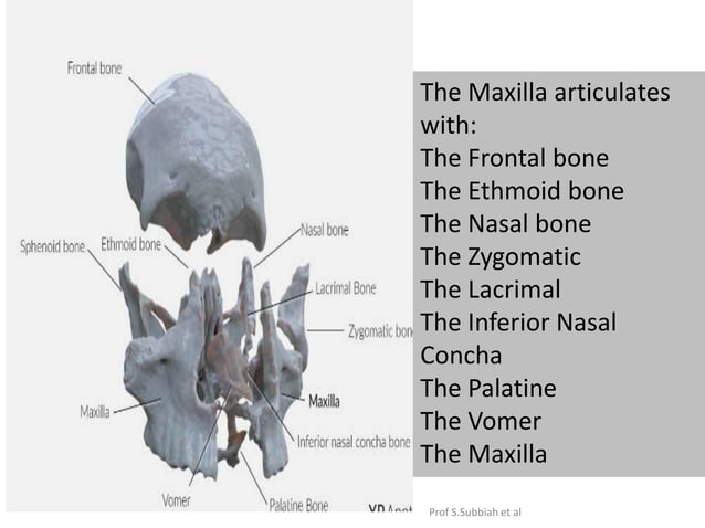 Carcinoma Maxillary sinus | PPTX