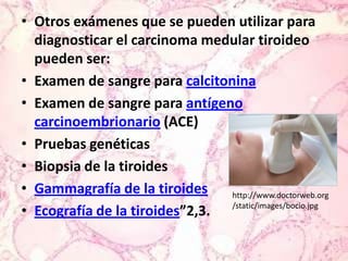 Otros exámenes que se pueden utilizar para diagnosticar el carcinoma medular tiroideo pueden ser:Examen de sangre para calcitoninaExamen de sangre para antígeno carcinoembrionario (ACE)Pruebas genéticasBiopsia de la tiroidesGammagrafía de la tiroidesEcografía de la tiroides”2,3.http://www.doctorweb.org/static/images/bocio.jpg