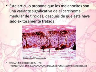 Este articulo propone que los melanocitos son una variante significativa de el carcinoma medular de tiroides, después de que esta haya sido exitosamente tratada.http://4.bp.blogspot.com/_Fnq-_ypIXdg/TO6t_bKf53I/AAAAAAAAAEg/QLDhcalP0hk/s1600/melanocitos.jpg