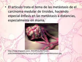 El articulo trata el tema de las metástasis de el carcinoma medular de tiroides, haciendo especial énfasis en las metástasis a distancias, especialmente en mama.http://4.bp.blogspot.com/_YmCZlFt2utM/TOv2n-jvZKI/AAAAAAAAABI/Kqnwuja7pLQ/s1600/CancerMetastasis.jpg