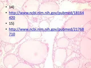 14)http://www.ncbi.nlm.nih.gov/pubmed/1816442015)http://www.ncbi.nlm.nih.gov/pubmed/21768710