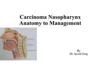 Carcinoma Nasopharynx
Anatomy to Management
By
Dr. Ayush Garg
 