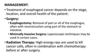 Carcinoma oesophagus. cancer of the eosophagus | PDF