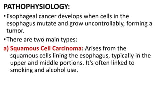 Carcinoma oesophagus. cancer of the eosophagus | PDF