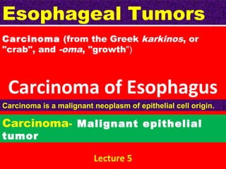 Esophageal Tumors
Carcinoma (from the Greek karkinos, or
"crab", and -oma, "growth")

Carcinoma of Esophagus
Carcinoma is a malignant neoplasm of epithelial cell origin.

Carcinoma- Malignant epithelial
tumor

Lecture 5

 
