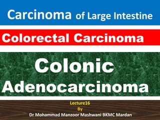 Carcinoma of Large Intestine
Colorectal Carcinoma

Colonic

Adenocarcinoma
Lecture16
By
Dr Mohammad Manzoor Mashwani BKMC Mardan

 
