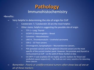 Pathology <ul><li>Immunohistochemistry </li></ul><ul><li>Benefits: </li></ul><ul><ul><li>Very helpful in determining the s...