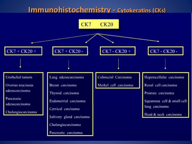 Carcinoma Of Unknown Primary