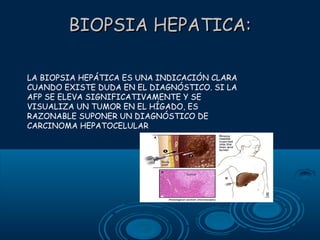 BIOPSIA HEPATICA:
LA BIOPSIA HEPÁTICA ES UNA INDICACIÓN CLARA
CUANDO EXISTE DUDA EN EL DIAGNÓSTICO. SI LA
AFP SE ELEVA SIGNIFICATIVAMENTE Y SE
VISUALIZA UN TUMOR EN EL HÍGADO, ES
RAZONABLE SUPONER UN DIAGNÓSTICO DE
CARCINOMA HEPATOCELULAR

 