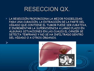 RESECCION QX.




LA RESECCIÓN PROPORCIONA LA MEJOR POSIBILIDAD
PARA UNA CURACIÓN. LA EXTRACCIÓN DE LA PARTE DEL
HÍGADO QUE CONTIENE EL TUMOR PUEDE SER CURATIVA,
E INCREMENTAR LA SUPERVIVENCIA A LARGO PLAZO EN
ALGUNAS SITUACIONES EN LAS CUALES EL CÁNCER SE
DETECTA TEMPRANO Y NO SE HA INFILTRADO DENTRO
DEL HÍGADO O A OTROS ÓRGANOS.

 