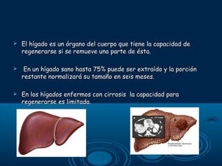 

El hígado es un órgano del cuerpo que tiene la capacidad de
regenerarse si se remueve una parte de ésta.



En un hígado sano hasta 75% puede ser extraído y la porción
restante normalizará su tamaño en seis meses.



En los hígados enfermos con cirrosis la capacidad para
regenerarse es limitada.

 