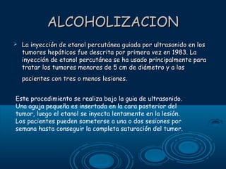 ALCOHOLIZACION


La inyección de etanol percutánea guiada por ultrasonido en los
tumores hepáticos fue descrita por primera vez en 1983. La
inyección de etanol percutánea se ha usado principalmente para
tratar los tumores menores de 5 cm de diámetro y a los
pacientes con tres o menos lesiones.

Este procedimiento se realiza bajo la guia de ultrasonido.
Una aguja pequeña es insertada en la cara posterior del
tumor, luego el etanol se inyecta lentamente en la lesión.
Los pacientes pueden someterse a una o dos sesiones por
semana hasta conseguir la completa saturación del tumor.

 