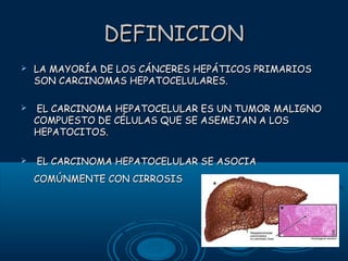 DEFINICION


LA MAYORÍA DE LOS CÁNCERES HEPÁTICOS PRIMARIOS
SON CARCINOMAS HEPATOCELULARES.



EL CARCINOMA HEPATOCELULAR ES UN TUMOR MALIGNO
COMPUESTO DE CÉLULAS QUE SE ASEMEJAN A LOS
HEPATOCITOS.



EL CARCINOMA HEPATOCELULAR SE ASOCIA
COMÚNMENTE CON CIRROSIS

 