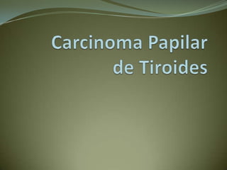 Carcinoma Papilar de Tiroides 