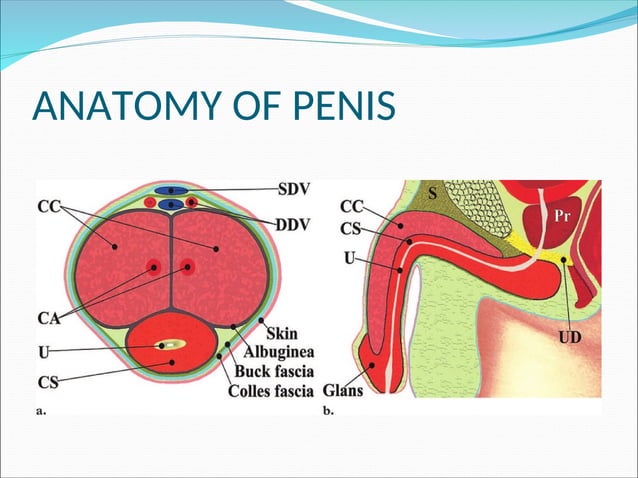 CARCINOMA PENIS Powerpoint Presentations PPT carcinoma-penis-powerpoint-presentations-ppt