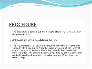 CARCINOMA PENIS powerpoint presentations