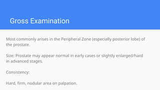 Most commonly arises in the Peripheral Zone (especially posterior lobe) of
the prostate.
Size: Prostate may appear normal in early cases or slightly enlarged/hard
in advanced stages.
Consistency:
Hard, firm, nodular area on palpation.
Gross Examination
 