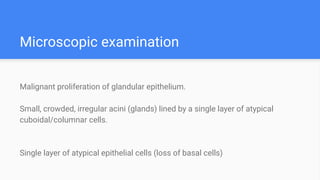 Malignant proliferation of glandular epithelium.
Small, crowded, irregular acini (glands) lined by a single layer of atypical
cuboidal/columnar cells.
Single layer of atypical epithelial cells (loss of basal cells)
Microscopic examination
 