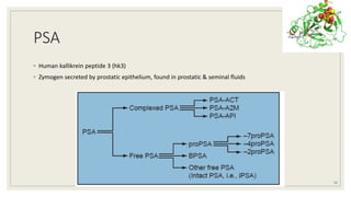 PSA
◦ Human kallikrein peptide 3 (hk3)
◦ Zymogen secreted by prostatic epithelium, found in prostatic & seminal fluids
12
 