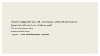 • TRUS showing hypo echoic lesion with seminal vescicle and bladder base involvement.
• Biopsy showing adeno carcinoma with gleason score 7
• CT scan no lymphadenopathy
• Bone scan – No hot spots
• Diagnosis – Locally advanced prostatic carcinoma
124
 