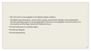 ◦ P/A a firm 3x3 cm mass palpable in the abdomen below umbilicus
◦ On Digital rectal examination , he has a Hard, nodular, asymmetrical swelling in the prostate gland
Firmness extending superior to the prostate gland. There was a mass palpable in the anal canal at 12 o
clock position and the finger stained with blood and mucus.
• He had tenderness at L1 vertebra region.
• His PSA was 30ng/ml.
• He had hyponatremia.
126
 