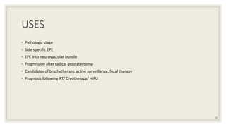 USES
◦ Pathologic stage
◦ Side specific EPE
◦ EPE into neurovascular bundle
◦ Progression after radical prostatectomy
◦ Candidates of brachytherapy, active surveillance, focal therapy
◦ Prognosis following RT/ Cryotherapy/ HIFU
33
 