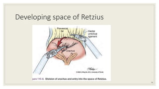 Developing space of Retzius
58
 