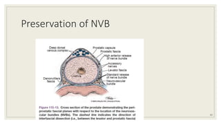 Preservation of NVB
63
 