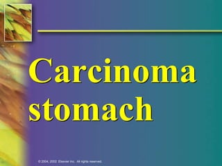 Carcinoma 
stomach 
© 2004, 2002 Elsevier Inc. All rights reserved. 
 