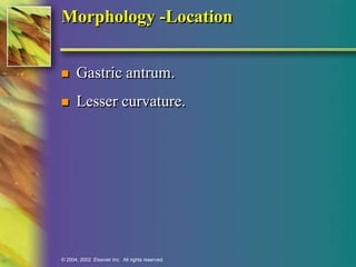 Morphology -Location 
 Gastric antrum. 
 Lesser curvature. 
© 2004, 2002 Elsevier Inc. All rights reserved. 
 