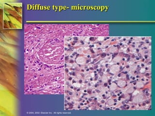 Diffuse type- microscopy 
© 2004, 2002 Elsevier Inc. All rights reserved. 
 