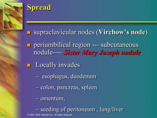 Spread 
 supraclavicular nodes (Virchow’s node) 
 periumbilical region --- subcutaneous 
nodule---- Sister Mary Joseph nodule. 
 Locally invades 
– esophagus, duodenum 
– colon, pancreas, spleen 
– omentum, 
– seeding of peritoneum , lung/liver 
© 2004, 2002 Elsevier Inc. All rights reserved. 
 