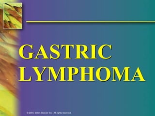GASTRIC 
LYMPHOMA 
© 2004, 2002 Elsevier Inc. All rights reserved. 
 