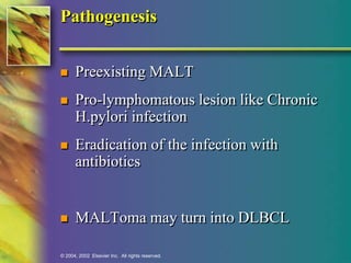 Pathogenesis 
 Preexisting MALT 
 Pro-lymphomatous lesion like Chronic 
H.pylori infection 
 Eradication of the infection with 
antibiotics 
 MALToma may turn into DLBCL 
© 2004, 2002 Elsevier Inc. All rights reserved. 
 
