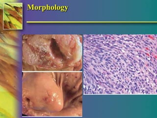 Morphology 
© 2004, 2002 Elsevier Inc. All rights reserved. 
 
