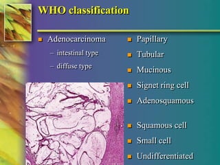 WHO classification 
 Adenocarcinoma 
– intestinal type 
– diffuse type 
© 2004, 2002 Elsevier Inc. All rights reserved. 
 Papillary 
 Tubular 
 Mucinous 
 Signet ring cell 
 Adenosquamous 
 Squamous cell 
 Small cell 
 Undifferentiated 
 