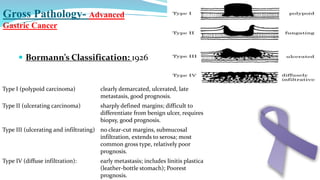 Carcinoma stomach- A Brief Overview- Part 1 | PPTX