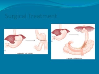 Surgical Treatment
 
