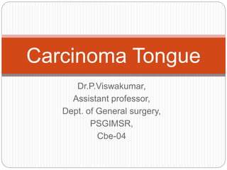 Dr.P.Viswakumar,
Assistant professor,
Dept. of General surgery,
PSGIMSR,
Cbe-04
Carcinoma Tongue
 
