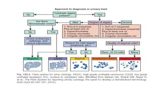 Comprehensive Overview of Urinary Bladder Carcinoma: Anatomy ...