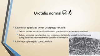 • Las células epiteliales tienen un aspecto variable:
• Células basales: son de proliferación activa que descansan en la membrana basal.
• Células luminales: característica más importante del epitelio vesical, tienen forma de
paraguas que están unidas entre si por células herméticas.
• Lámina propia: tejido conectivo liso.
Urotelio normal 😒🔬
 