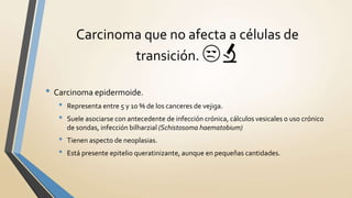 • Carcinoma epidermoide.
• Representa entre 5 y 10 % de los canceres de vejiga.
• Suele asociarse con antecedente de infección crónica, cálculos vesicales o uso crónico
de sondas, infección bilharzial (Schistosoma haematobium)
• Tienen aspecto de neoplasias.
• Está presente epitelio queratinizante, aunque en pequeñas cantidades.
Carcinoma que no afecta a células de
transición. 😒🔬
 