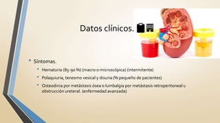 Datos clínicos. 📋🏢
• Síntomas.
• Hematuria (85-90 %) (macro o microscópica) (intermitente)
• Polaquiuria, tenesmo vesical y disuria (% pequeño de pacientes)
• Osteodinia por metástasis ósea o lumbalgia por metástasis retroperitoneal u
obstrucción ureteral. (enfermedad avanzada)
 
