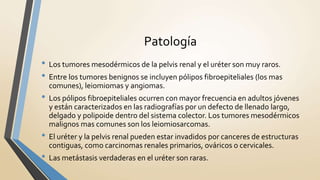 Patología
• Los tumores mesodérmicos de la pelvis renal y el uréter son muy raros.
• Entre los tumores benignos se incluyen pólipos fibroepiteliales (los mas
comunes), leiomiomas y angiomas.
• Los pólipos fibroepiteliales ocurren con mayor frecuencia en adultos jóvenes
y están caracterizados en las radiografías por un defecto de llenado largo,
delgado y polipoide dentro del sistema colector. Los tumores mesodérmicos
malignos mas comunes son los leiomiosarcomas.
• El uréter y la pelvis renal pueden estar invadidos por canceres de estructuras
contiguas, como carcinomas renales primarios, ováricos o cervicales.
• Las metástasis verdaderas en el uréter son raras.
 